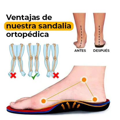 SANDALIAS ORTOPÉDICAS 🤩😱 - Ofertas